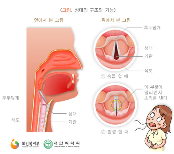 성대 결절의 증상, 원인 및 치료-수술비용 등