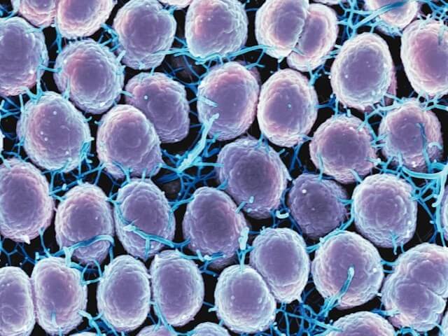 성병, 오직 성 접촉만으로 전염되는 건 아니에요! 놀랍게도 이런 방법으로도 감염될 수 있어요