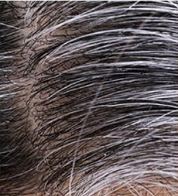 흰머리 예방과 관리법: 피할 수 없는 노화의 증거, 흰머리를 어떻게 관리해야 할까?