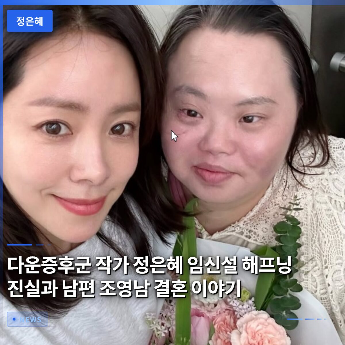 다운증후군 작가 정은혜 임신설 해프닝 진실과 남편 조영남 결혼 이야기
